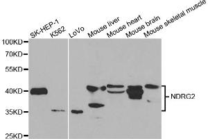 Western blot analysis of extracts of various cell lines, using NDRG2 antibody (ABIN5973062) at 1/1000 dilution. (NDRG2 Antikörper)