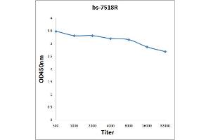 Antigen: 0. (RNH1 Antikörper  (AA 101-200))