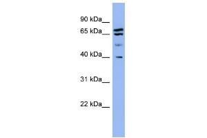 WB Suggested Anti-SH3GL2 Antibody Titration: 0. (SH3G2 Antikörper  (Middle Region))
