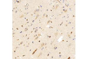 anti-Solute Carrier Family 25, Member 13 (Citrin) (slc25a13) (AA 1-643) antibody