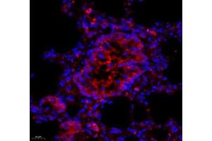 Immunofluorescence of paraffin embedded rat lung using ARHGAP18 (ABIN7075417) at dilution of 1: 700 (400x lens) (ARHGAP18 Antikörper)