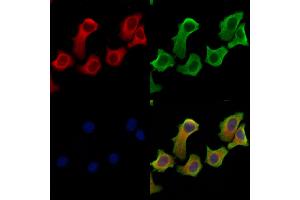 ABIN6264961 and ABIN6279698 staining Hela cells by IF/ICC.