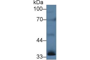 Western blot analysis of Rat Testis lysate, using Human INHA Antibody (5 µg/ml) and HRP-conjugated Goat Anti-Rabbit antibody ( (Inhibin alpha Antikörper  (AA 25-363))