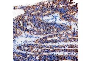 IHC analysis of PGRMC1 using anti-PGRMC1 antibody (ABIN3043899).