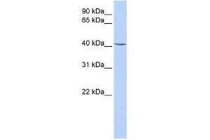 GPD1 antibody used at 1 ug/ml to detect target protein. (GPD1 Antikörper)