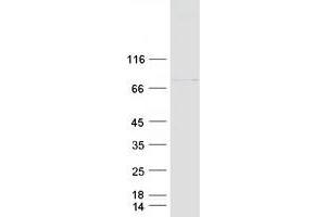 Western Blotting (WB) image for Fas (TNFRSF6) Associated Factor 1 (FAF1) protein (Myc-DYKDDDDK Tag) (ABIN2720692)