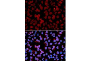 Immunofluorescence analysis of U2OS cell using TNFAIP3 antibody.