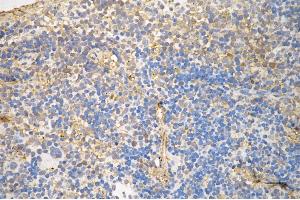 Immunohistochemistry was performed on paraffin-embedded mouse spleen using NF-kB p65 antibody (ABIN7799645), 1:200). (Rekombinanter NF-kB p65 Antikörper)