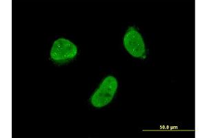 Immunofluorescence of monoclonal antibody to ZNF7 on HeLa cell. (ZNF7 Antikörper  (AA 67-165))