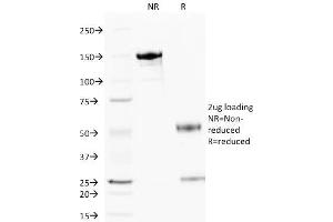 SDS-PAGE Analysis Purified Cytochrome C Mouse Monoclonal Antibody (6H2. (Cytochrome C Antikörper)