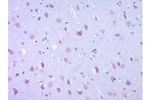 Immunohistochemistry (Paraffin-embedded Sections) (IHC (p)) image for anti-Leptin (LEP) (AA 17-100) antibody (ABIN668243)