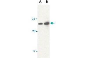 Western blot analysis of STRADB in human brain lysate with STRADB polyclonal antibody  at (A) 1 and (B) 2 ug/mL . (STRADB Antikörper  (Internal Region))