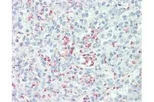 Anti-Mannose Receptor / CD206 antibody IHC staining of human spleen.