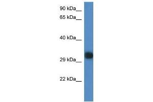 Mouse Spleen; WB Suggested Anti-Gm527 Antibody. (GM527 Antikörper  (C-Term))