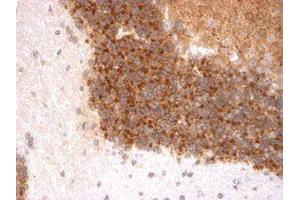 Immunohistochemistry (IHC) image for anti-Potassium Voltage-Gated Channel, Shal-Related Subfamily, Member 3 (KCND3) (C-Term) antibody (ABIN6658138)