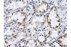 Immunohistochemistry (IHC) image for anti-Aconitase 2, Mitochondrial (ACO2) antibody (ABIN1496412) (ACO2 Antikörper)