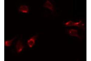 ABIN6268816 staining 293 by IF/ICC. (HNRNPA1 Antikörper  (Internal Region))
