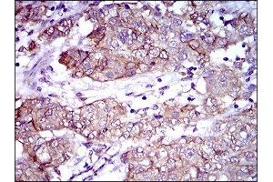Immunohistochemistry (IHC) image for anti-Activated Leukocyte Cell Adhesion Molecule (ALCAM) (AA 48-216) antibody (ABIN1846222) (CD166 Antikörper  (AA 48-216))