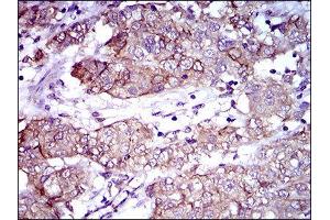 Immunohistochemistry (IHC) image for anti-Activated Leukocyte Cell Adhesion Molecule (ALCAM) (AA 48-216) antibody (ABIN1846222)