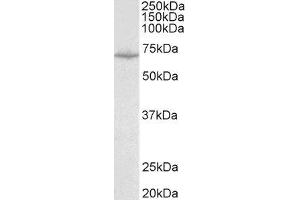 ABIN2559988 (0. (SLC6A8 Antikörper  (Internal Region))