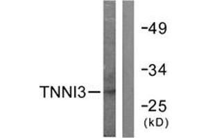 Western blot analysis of extracts from mouse heart cells, using TNNI3 (Ab-142) Antibody. (TNNI3 Antikörper  (AA 111-160))