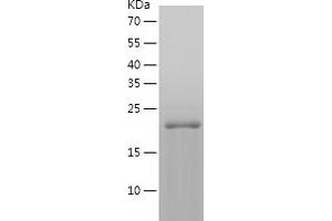 Western Blotting (WB) image for Ras Homolog Gene Family, Member A (RHOA) (AA 1-193) protein (His tag) (ABIN7124784)