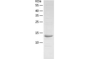 Western Blotting (WB) image for Hephaestin (HEPH) (AA 968-1124) protein (His tag) (ABIN7123315) (Hephaestin Protein (HEPH) (AA 968-1124) (His tag))