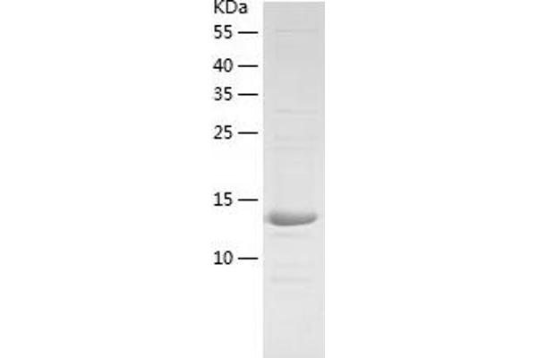 Hephaestin Protein (HEPH) (AA 968-1124) (His tag)