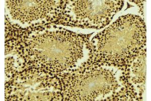 ABIN6268876 at 1/100 staining Mouse testis tissue by IHC-P. (PIAS4 Antikörper  (C-Term))