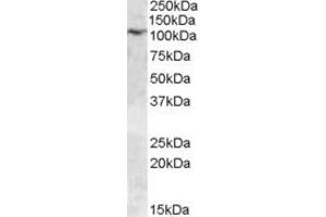 Western Blotting (WB) image for anti-Transient Receptor Potential Cation Channel, Subfamily C, Member 6 (TRPC6) (AA 918-931) antibody (ABIN490466) (TRPC6 Antikörper  (AA 918-931))