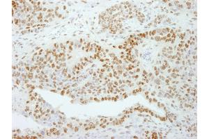 Immunohistochemistry (IHC) image for anti-General Transcription Factor III (GTF2I) (AA 985-998) antibody (ABIN7448971) (GTF2I Antikörper  (AA 985-998))