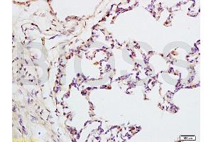 Formalin-fixed and rat lung tissue labeled with Anti-IQGAP1 Polyclonal Antibody, Unconjugated (ABIN737796) at 1:200 followed by conjugation to the secondary antibody and DAB staining