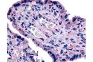 Immunohistochemistry (IHC) image for anti-Solute Carrier Family 7 (Cationic Amino Acid Transporter, Y+ System), Member 5 (SLC7A5) (N-Term) antibody (ABIN2469356)