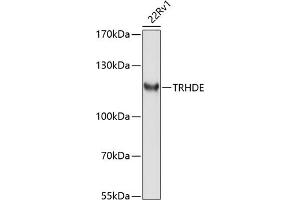 Western blot analysis of extracts of 22Rv1 cells, using TRHDE antibody (ABIN6132912, ABIN6149490, ABIN6149491 and ABIN6214501) at 1:1000 dilution. (TRHDE Antikörper  (AA 62-200))