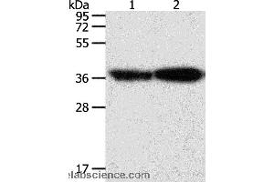 Western blot analysis of Human leiomyosarcoma and mouse testis tissue, using TPM2 Polyclonal Antibody at dilution of 1:1000 (TPM2 Antikörper)