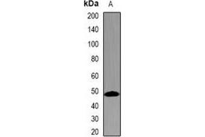 Western blot analysis of TMPRSS2 expression in 22RV1 (A) whole cell lysates.