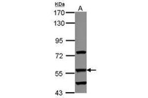 Image no. 2 for anti-Dihydrouridine Synthase 2-Like (DUS2L) (AA 1-199) antibody (ABIN1497929) (DUSL2 Antikörper  (AA 1-199))