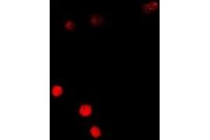 Immunofluorescent analysis of SSX5 staining in A549 cells. (SSX5 Antikörper)
