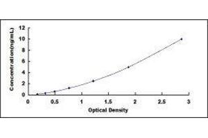 VEGF Receptor 2 (VEGFR2) ELISA Kit