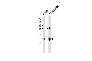Western blot analysis of lysates from K562 cell line and human placenta tissue lysate (from left to right), using HBG2 Antibody (C-term) (ABIN1944740 and ABIN2838564). (HBG2 Antikörper  (C-Term))