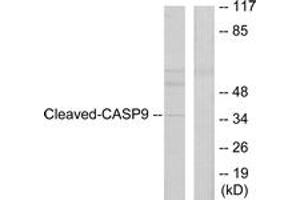 Western blot analysis of extracts from HeLa cells, treated with Etoposide 25uM 60', using Caspase 9 (Cleaved-Asp330) Antibody. (Caspase 9 Antikörper  (Cleaved-Asp330))