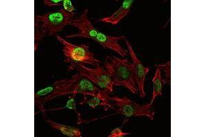 Immunofluorescence analysis of U251 cells using OTX2 mouse mAb (green). (OTX2 Antikörper)