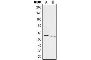 Western blot analysis of PRPF19 expression in HepG2 (A), HeLa (B) whole cell lysates. (PRP19 Antikörper  (Center))