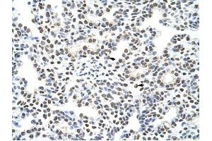HNRPA3 antibody was used for immunohistochemistry at a concentration of 4-8 ug/ml to stain Alveolar cells (arrows) in Human Lung. (HNRNPA3 Antikörper  (N-Term))