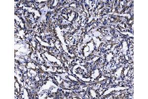 IHC analysis of TOMM70 using anti-TOMM70 antibody (ABIN7599855).