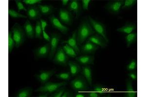 Immunofluorescence of monoclonal antibody to S100A13 on HeLa cell.