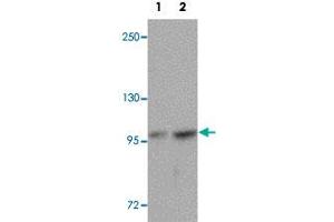 Western blot analysis of FREM2 in A-20 cell lysate with FREM2 polyclonal antibody  at (1) 0. (FREM2 Antikörper  (Internal Region))