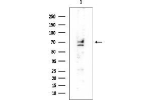 Western blot analysis of lysates from PC12 cells, using NUMB Mouse Monoclonal Antibody at 1/1000 dilution.