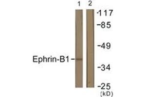 Western blot analysis of extracts from COS7 cells, using EFNB1 (Ab-317) Antibody. (Ephrin B1 Antikörper  (AA 283-332))