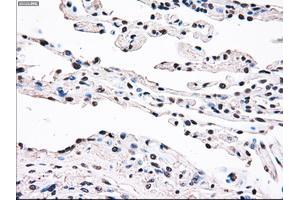 Immunohistochemical staining of paraffin-embedded prostate tissue using anti-SSBmouse monoclonal antibody. (SSB Antikörper)